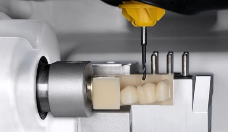 Hochwertiger Vollkeramik Zahnersatz mit CAM-CAD Technologie bei Dentication in Bad Homburg