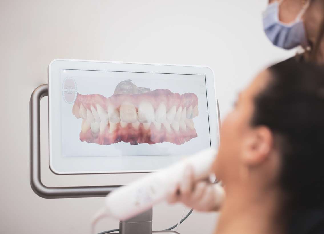 Technische Ausstattung DENTICATION Bad Homburg - Intraoral Scanner bei Zahnarzt H. Bolahrir