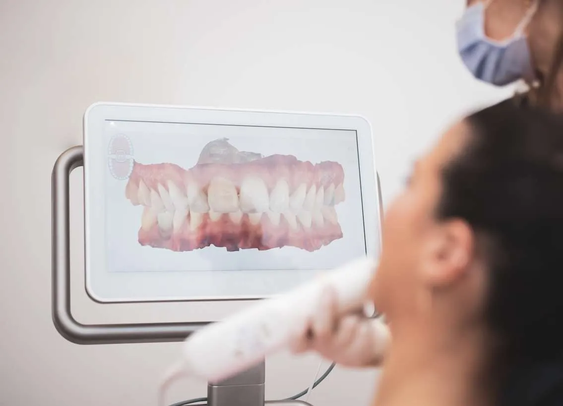 Technische Ausstattung DENTICATION Bad Homburg - Intraoral Scanner bei Zahnarzt H. Bolahrir